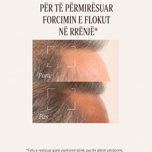 Serum Kundër Rënies së Flokëve
