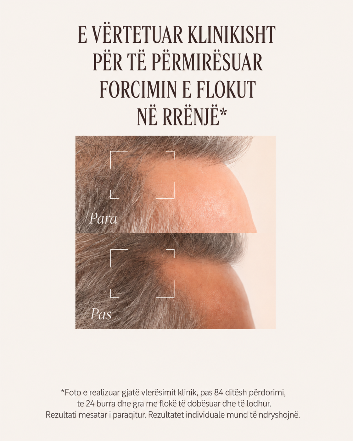 Serum Kundër Rënies së Flokëve